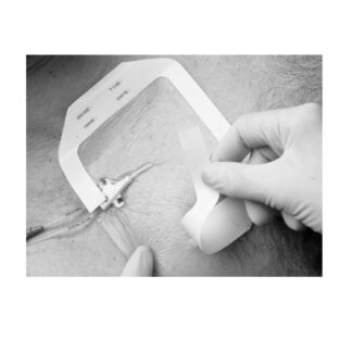 Solventum Tegaderm™ Transparent Film Dressing 1630