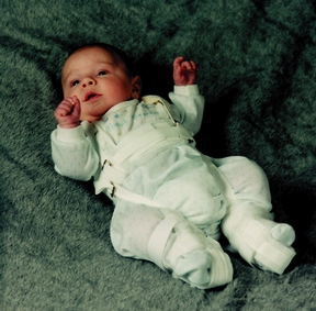 Scott Specialties Pavlik Harness 0260