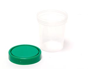 Pro Advantage Urine Specimen Containers P250415