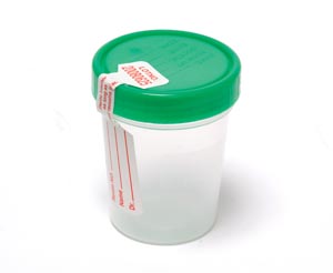 Pro Advantage Urine Specimen Containers P250410