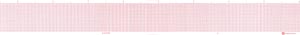 Graphic Controls Cardiology Chart Paper 7g10669183