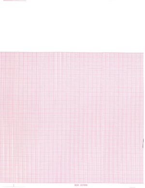 Graphic Controls Cardiology Chart Paper 7g20608594