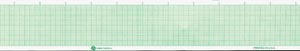 Graphic Controls Cardiology Chart Paper 7g30718970