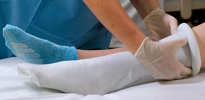 Alba Sterile Pre-cut Stockinette 8066