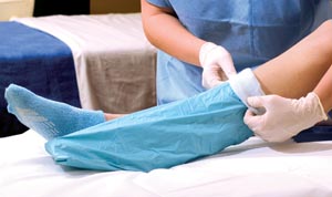 Alba Sterile Stockinette 21048