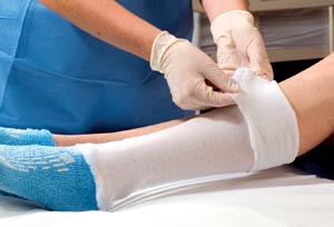 Alba Non-sterile Stockinette 86812