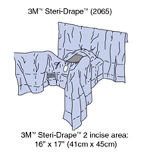 3m General Surgery Drapes 2065