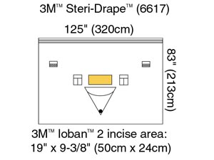 3m Steri-drape Patient Isolation Drapes 6617