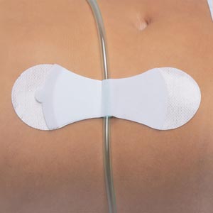 Tidi Grip-lok Universal Securement Device 3400l