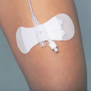 Tidi Grip-lok Foley Securement Device 3400lfc